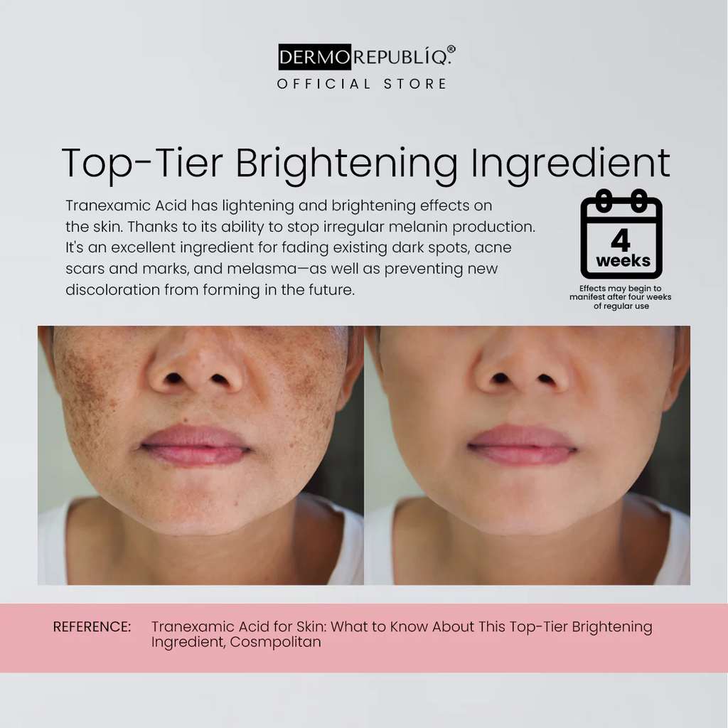 Dermorepubliq 10% Niacinamide + 3% Tranexamic Acid + 2% Alpha Arbutin Ultra White Serum - 30 mL